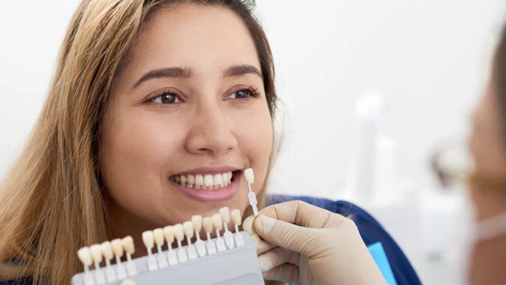 What is the Cost of Veneers?