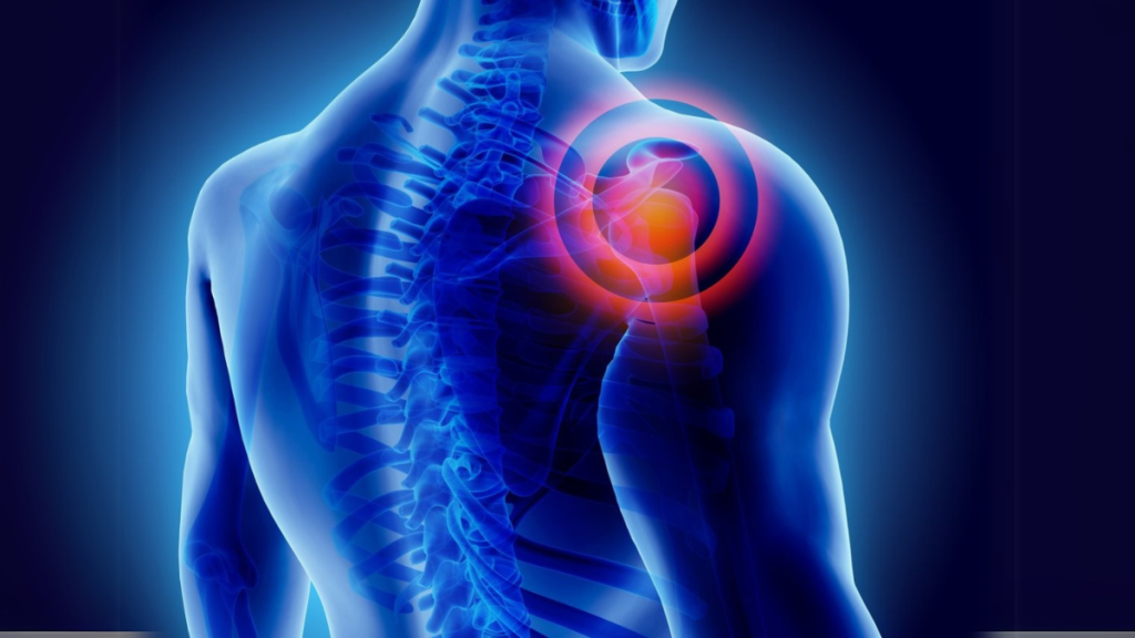 Understanding Musculoskeletal Disorders and Their Impact on Daily Life