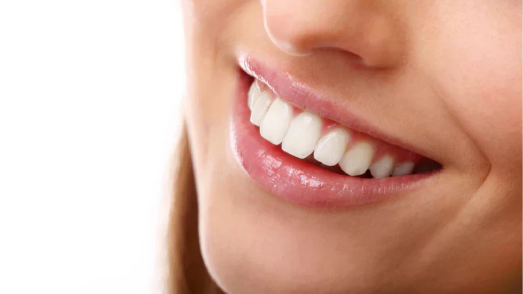 At Risk of Overcrowding? Three Ways to Maintain a Perfect Smile