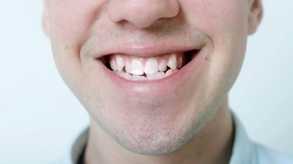 Can a Misaligned Jaw Really Affect More Than Just Your Smile?